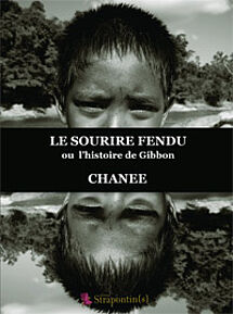 Le sourire fendu ou l’histoire de Gibbon